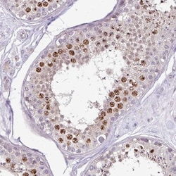IMUP Antibody, Novus Biologicals 25 &mu;L, Unlabeled:Antibodies, Polyclonal